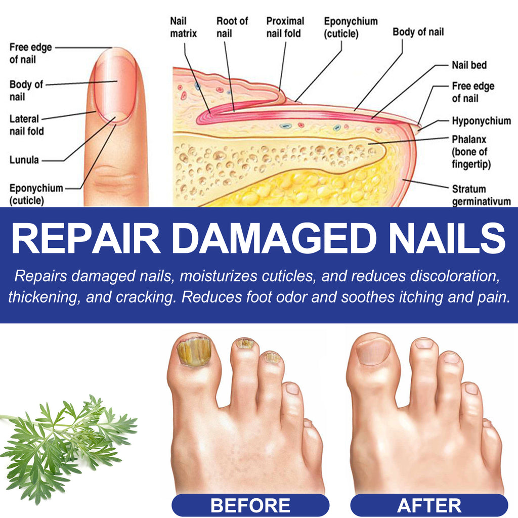 Foot Care Package Repair Soreness And Swelling Relief Foot Soak Foot Clean Nail Calluses Foot Bath Package