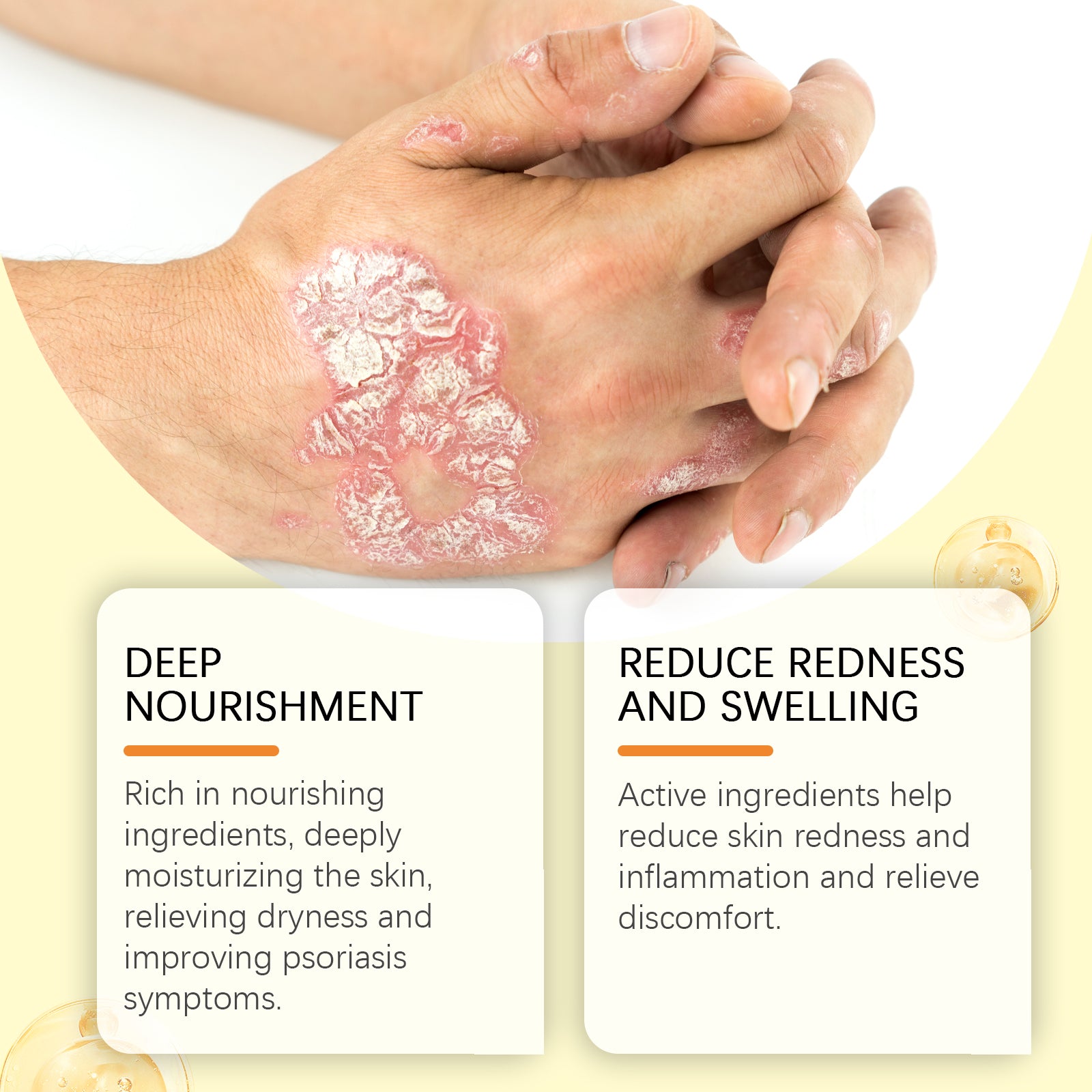 Skin Care Essence, Gently Nourishing And Hydrating Body Skin Care Essence