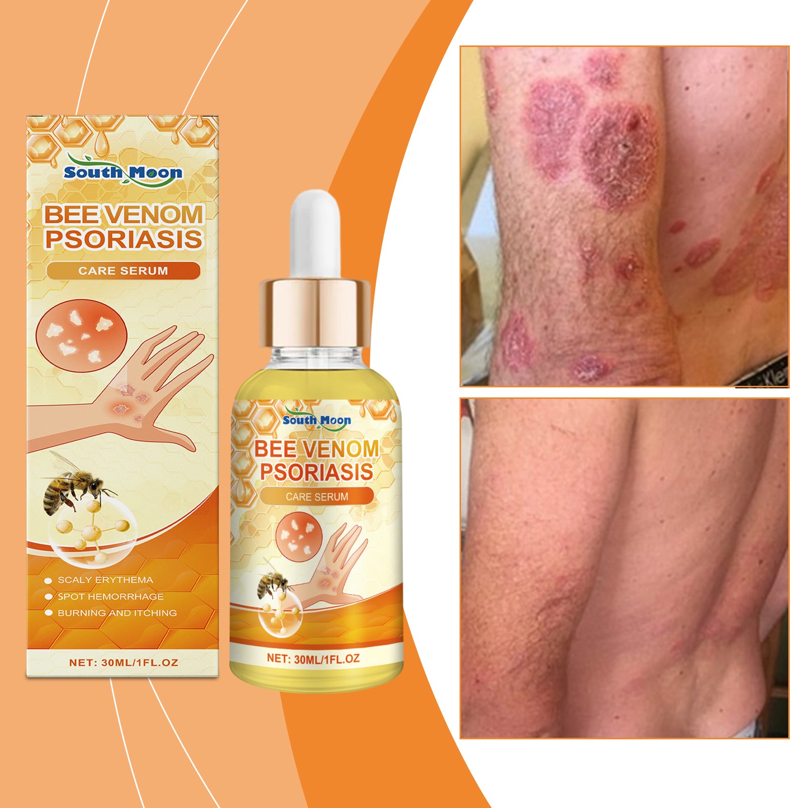 Skin Care Essence, Gently Nourishing And Hydrating Body Skin Care Essence