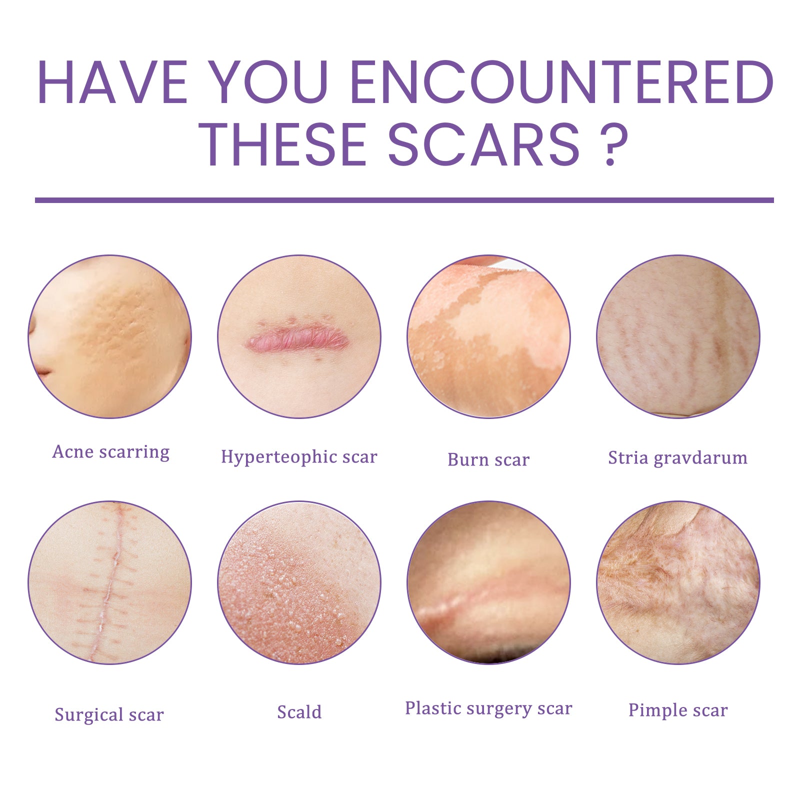 Skin Care Cream, Daily Moisturizing, Smoothing And Firming Skin Repair Postpartum Repair Topical Cream