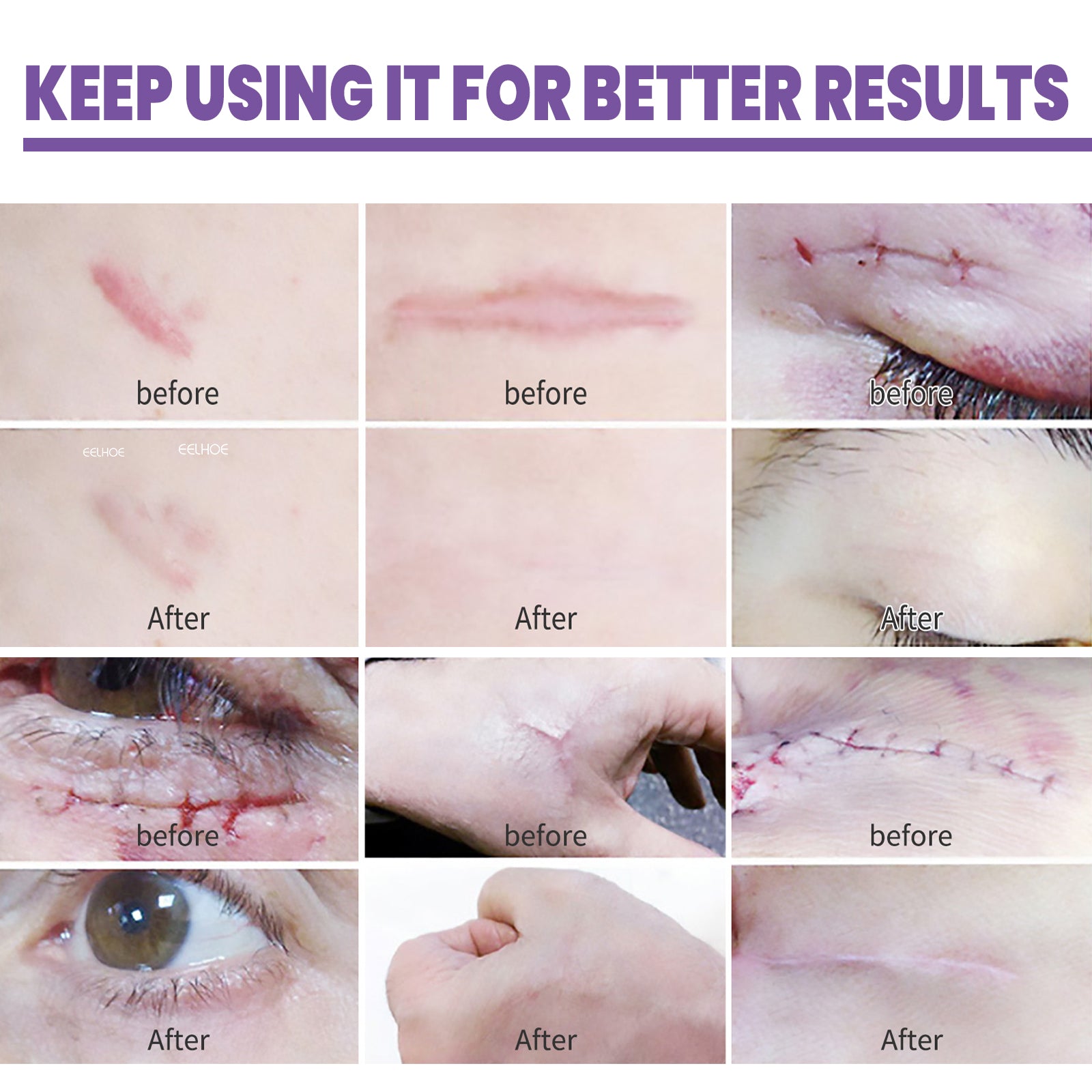 Skin Care Cream, Daily Moisturizing, Smoothing And Firming Skin Repair Postpartum Repair Topical Cream