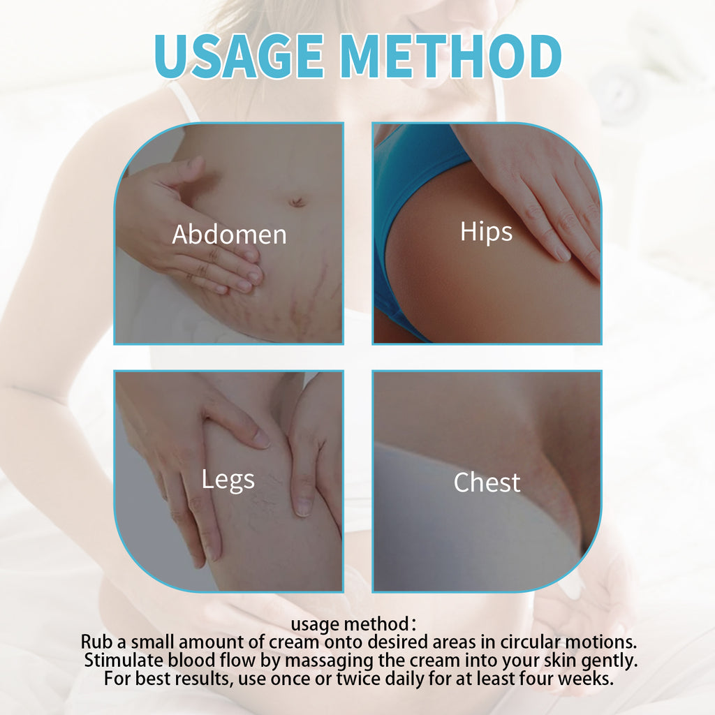 Stretch Marks Repair Cream, Moisturizing And Repairing Skin Lighten Pregnancy Scars Smooth Skin Care Cream